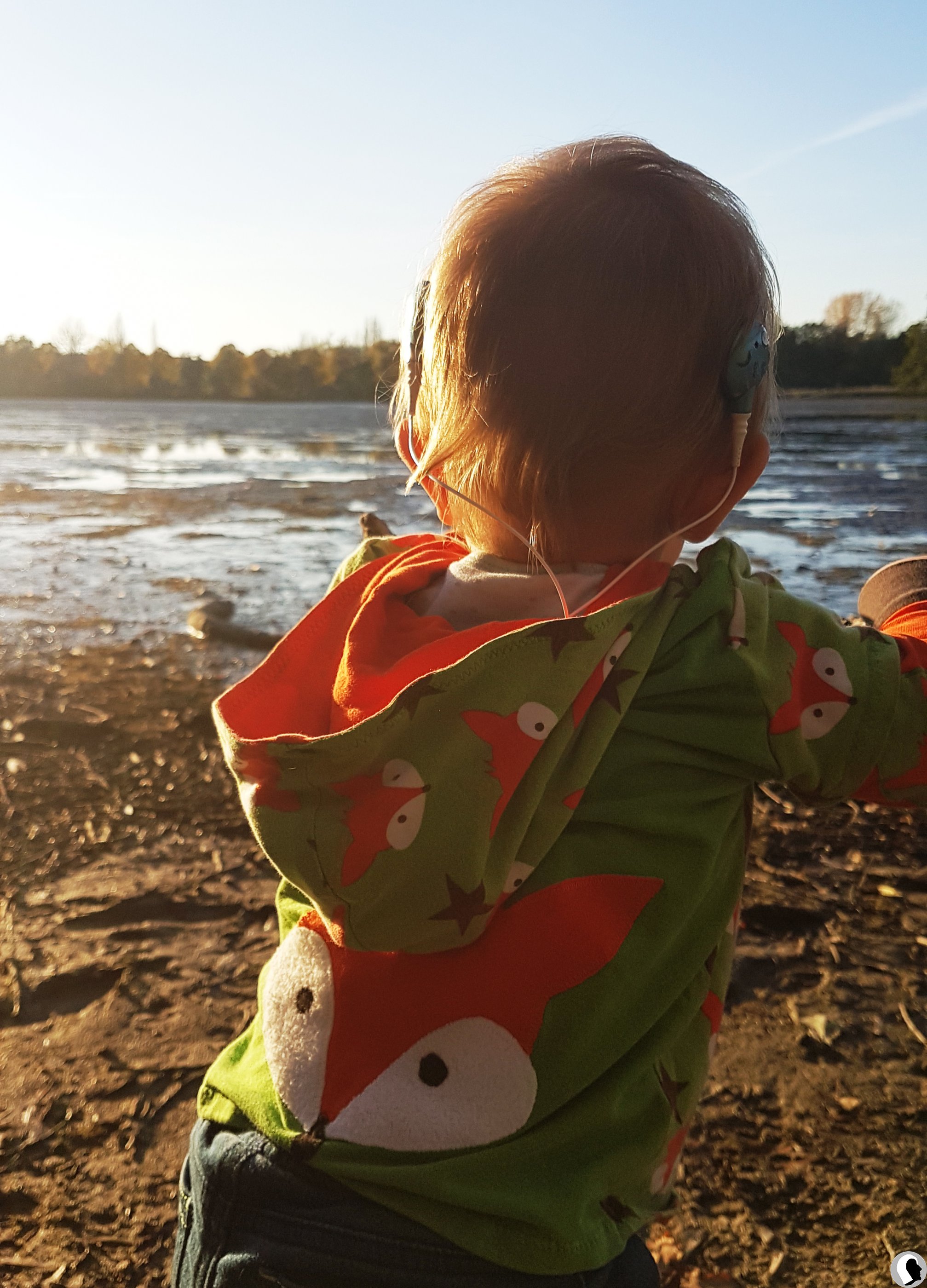 CI Kopf 2018 männlich Kind